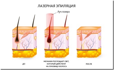 1jgdt14b